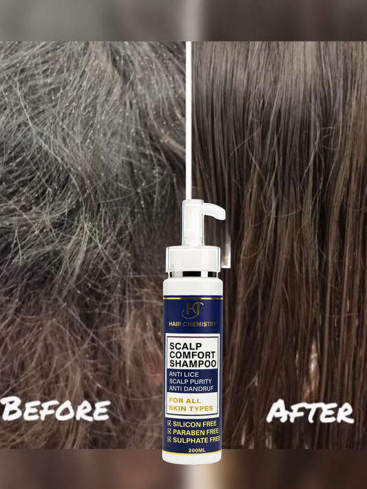 Anti-Lice Shampoo 200ml ( PREMIUM QUALITY )