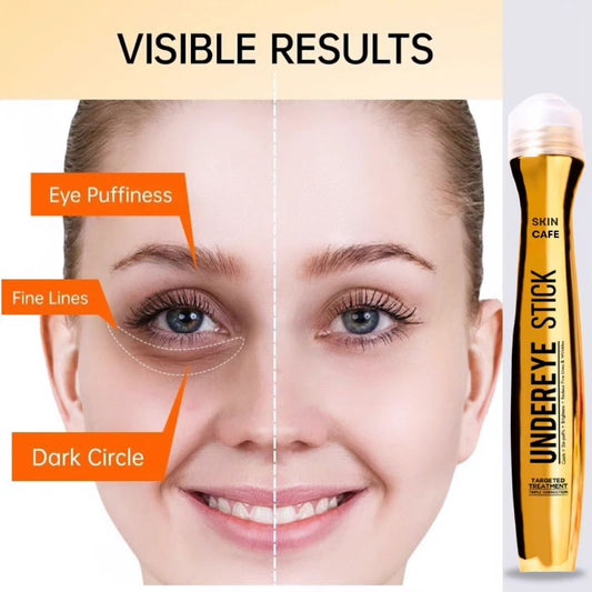 ANTI DARK CIRCLE SERUM (REMOVE DARK CIRCLE JUST IN 3 DAYS )