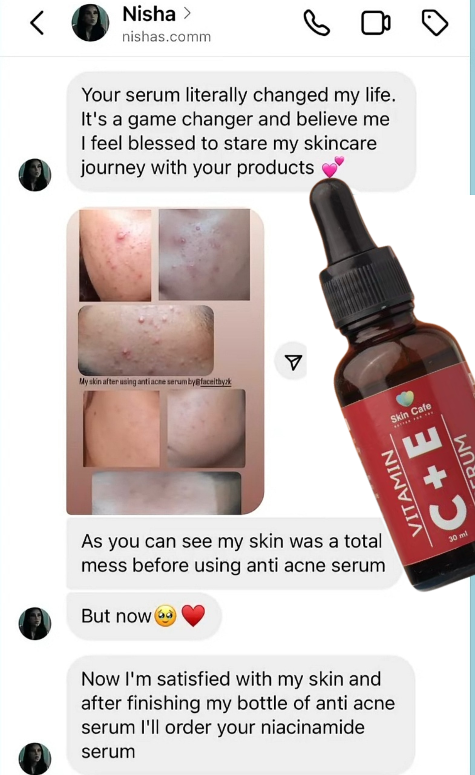 ANTI ACNE  SERUM REMOVE ACNE IN 3 DAYS !