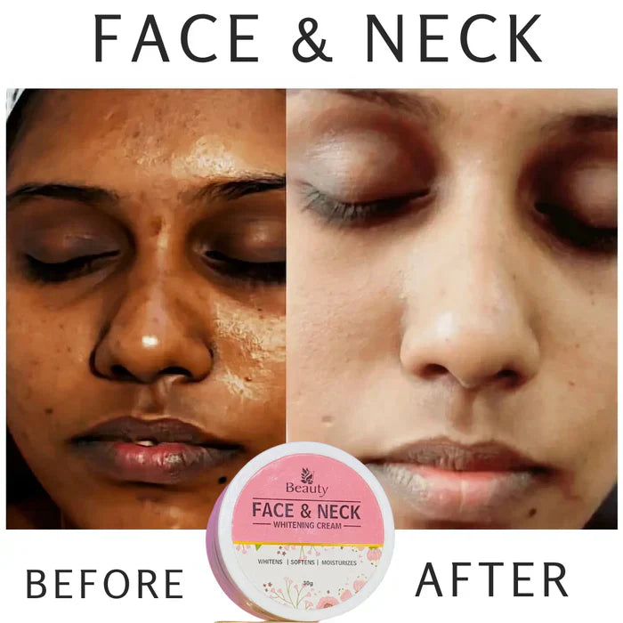 FACE & NECK WHITENING CREAM (PREMIUM QUALITY )