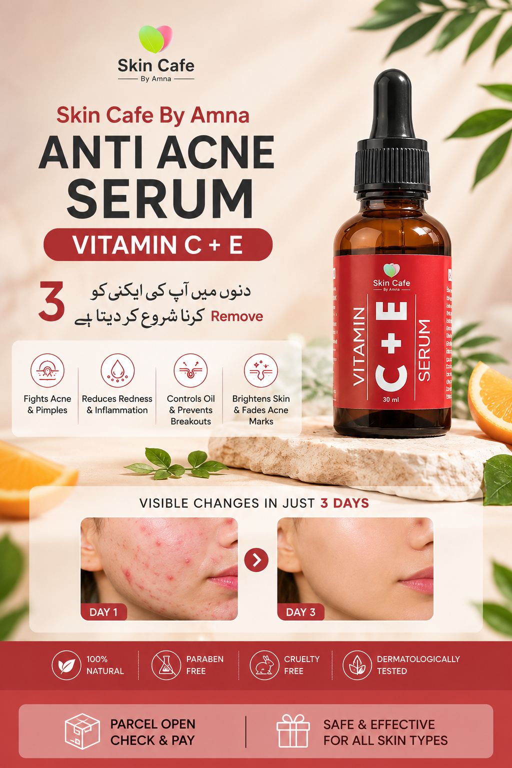 ANTI ACNE  SERUM REMOVE ACNE IN 3 DAYS !