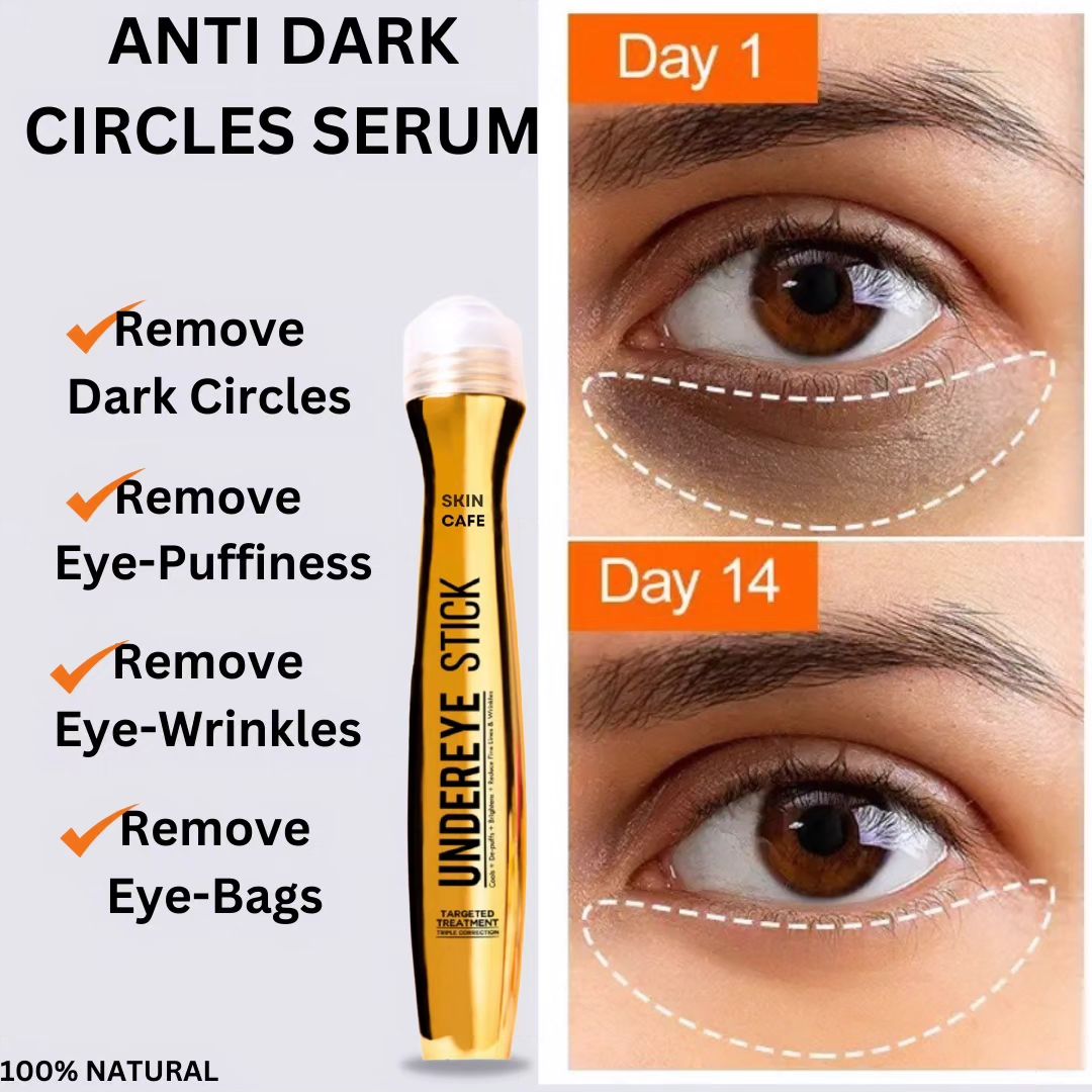 ANTI DARK CIRCLE SERUM (REMOVE DARK CIRCLE JUST IN 3 DAYS )