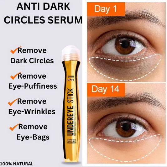 ANTI DARK CIRCLE SERUM (REMOVE DARK CIRCLE JUST IN 3 DAYS )