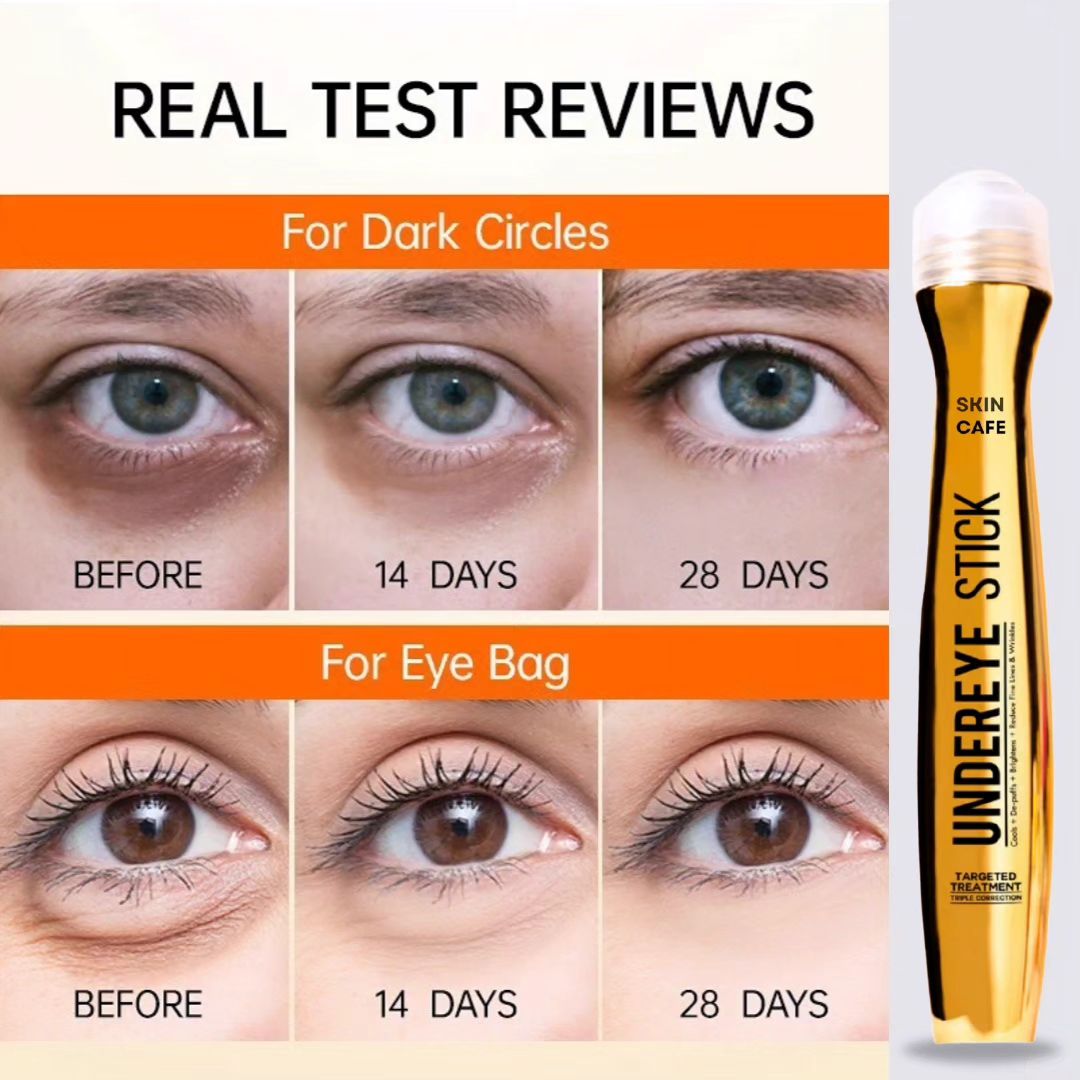 ANTI DARK CIRCLE SERUM (REMOVE DARK CIRCLE JUST IN 3 DAYS )